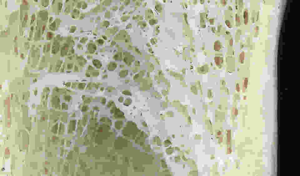 Scan of human tibia cut longitudinally shows the complex 3-D structure of trabecular bone. Not only does this bone provide distributed support for the knee joint (out of picture at the top), it also provides extremely high surface area for bone formation and resorption to regulate mineral homeostasis and bone remodeling (see Odgren et al., 2004. “Bone Structure,” in Encyclopedia of Endocrine Diseases, L Martini, ed. Vol. 1:392-400. Academic Press, San Diego).