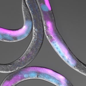 A picture of several worms is shown, overlayed with the expression pattern of two protein, TIR-1 in pink and POS-1 in blue.