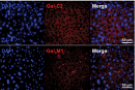 GalNAc conjugate delivery