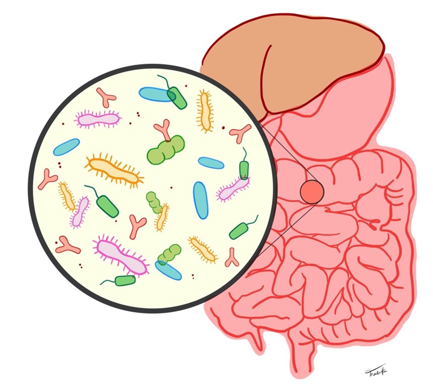 IBD