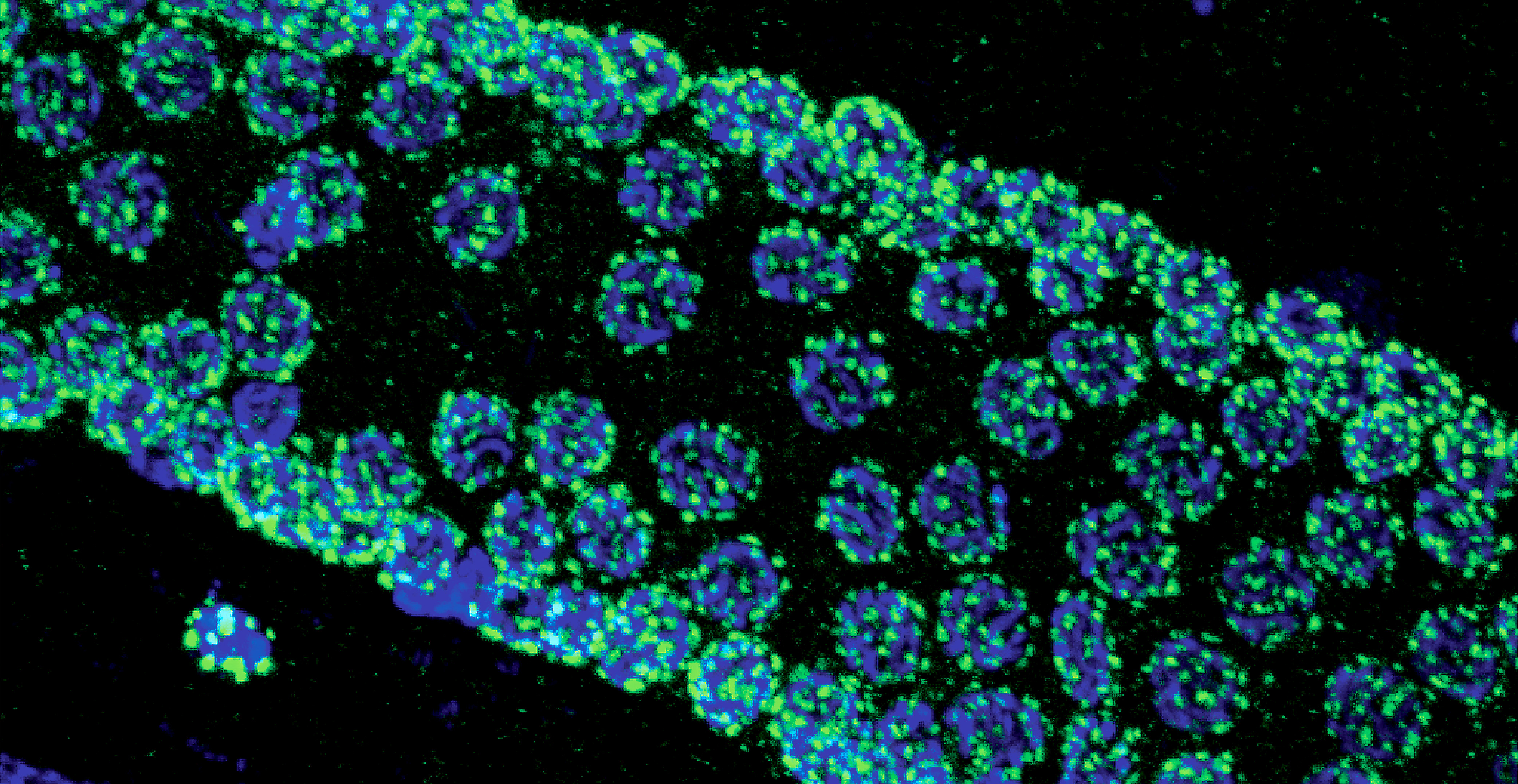  RNAi block image.jpg