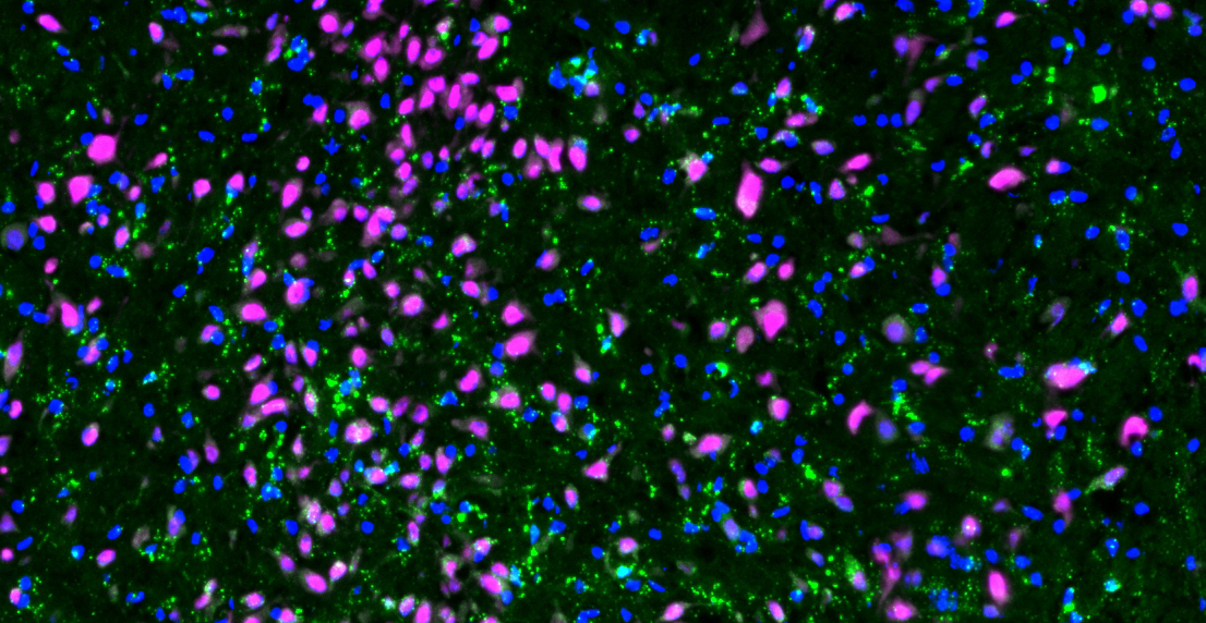  HTT ICV NeuN and CNPase mAb tests.lif_10 nmol Cy3 LNAASO NeuN back-cerebellumSnapshot1.jpg