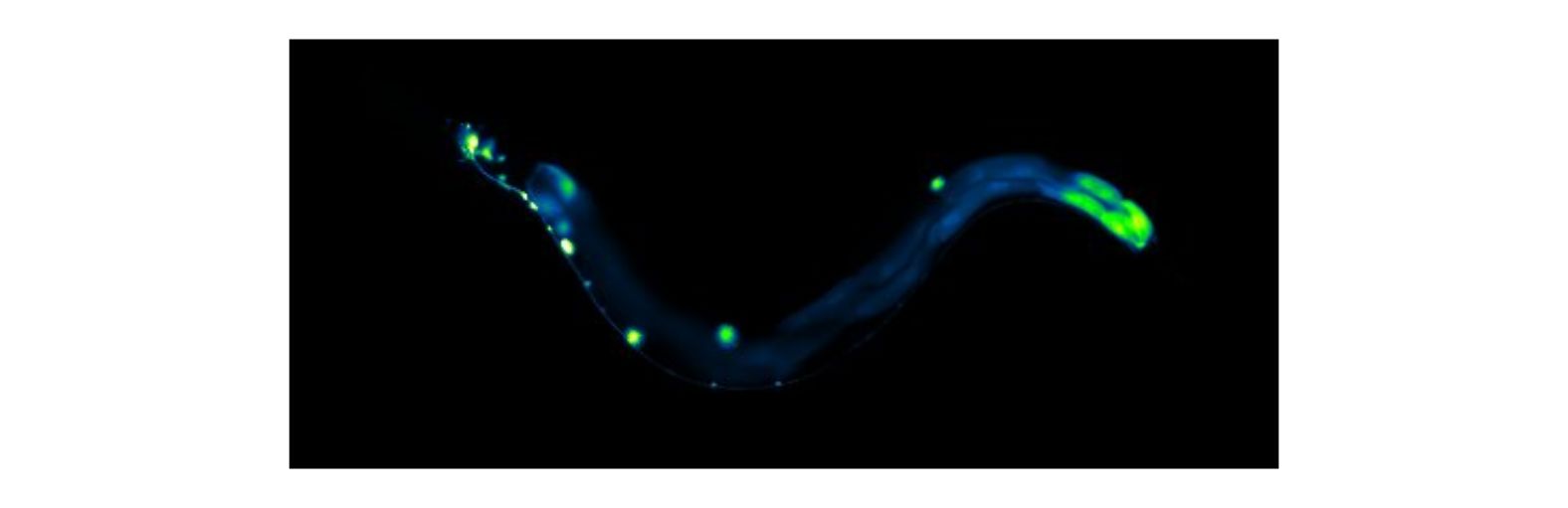 flp-18::GFP