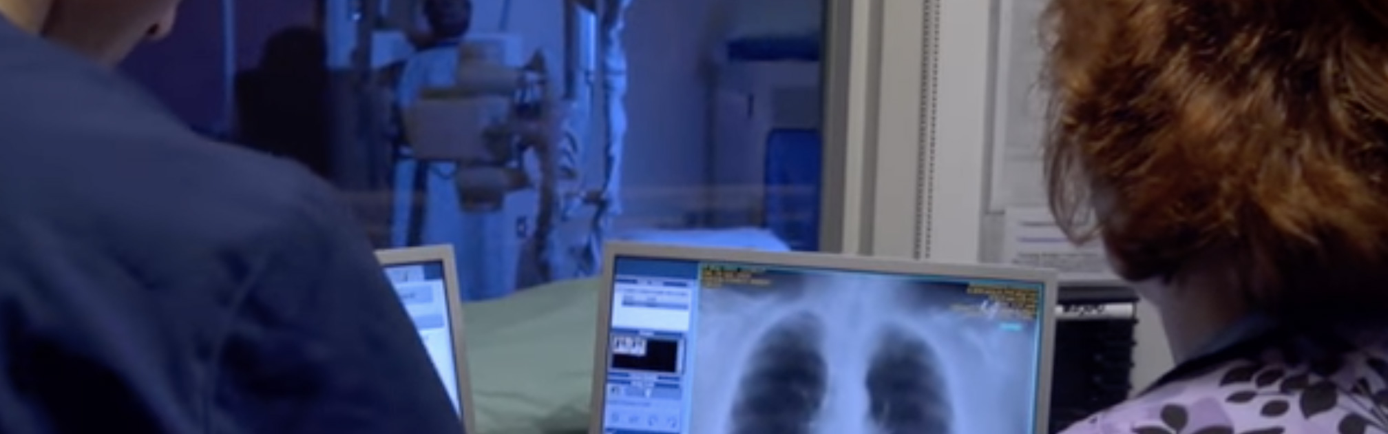 lung-cancer.jpg