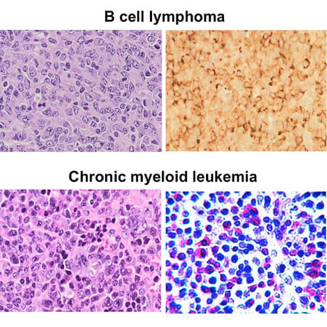 Tumorigenesis in Wnt5a-deficient mice.