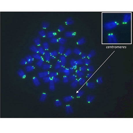 Loss of p53 induces chromosomal hyperploidy.