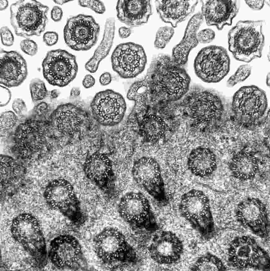 Cilia basal bodies and transition zone 