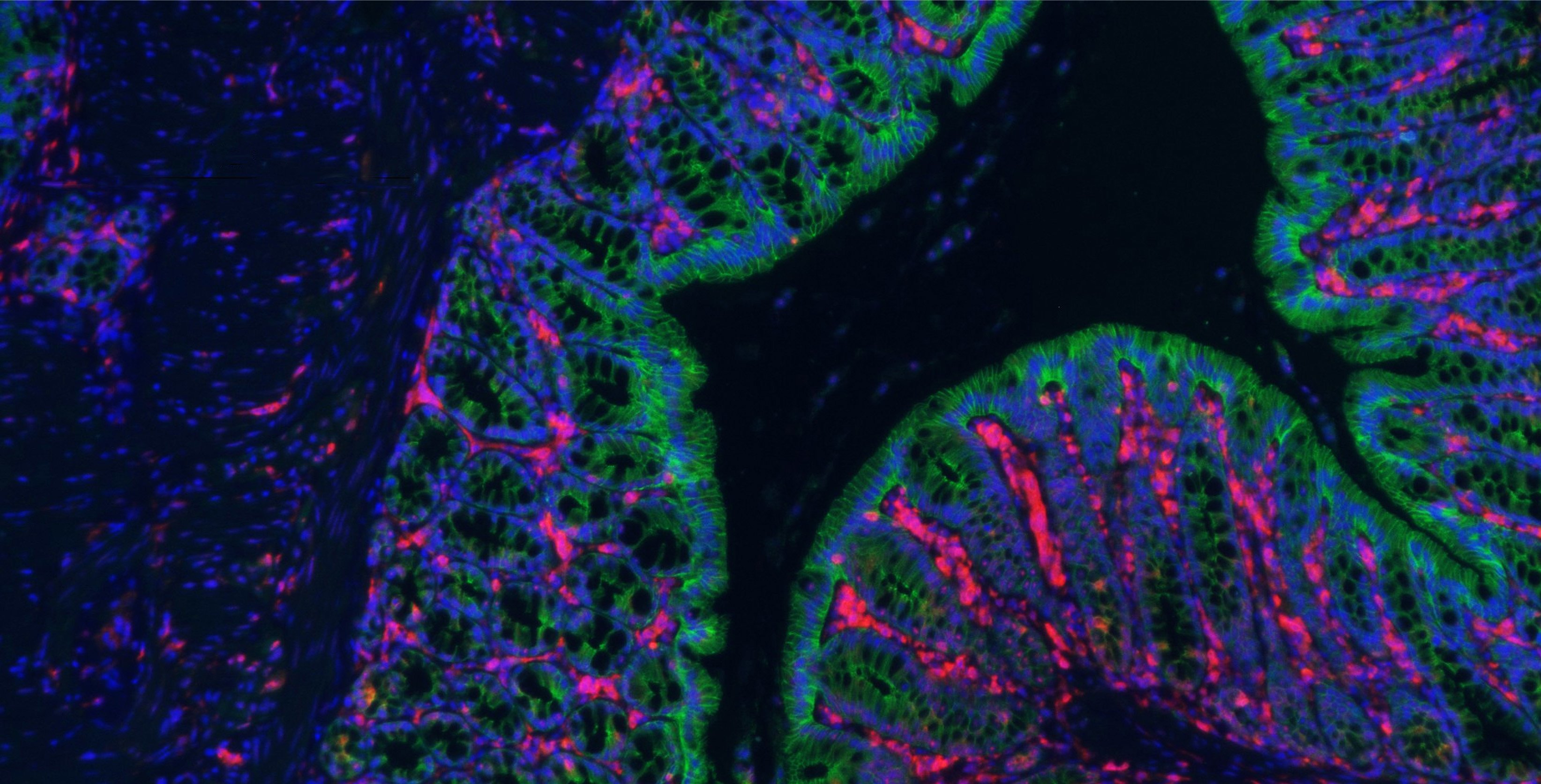  Program in Innate Immunity