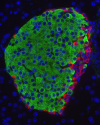 Human Type 1 Diabetes Research