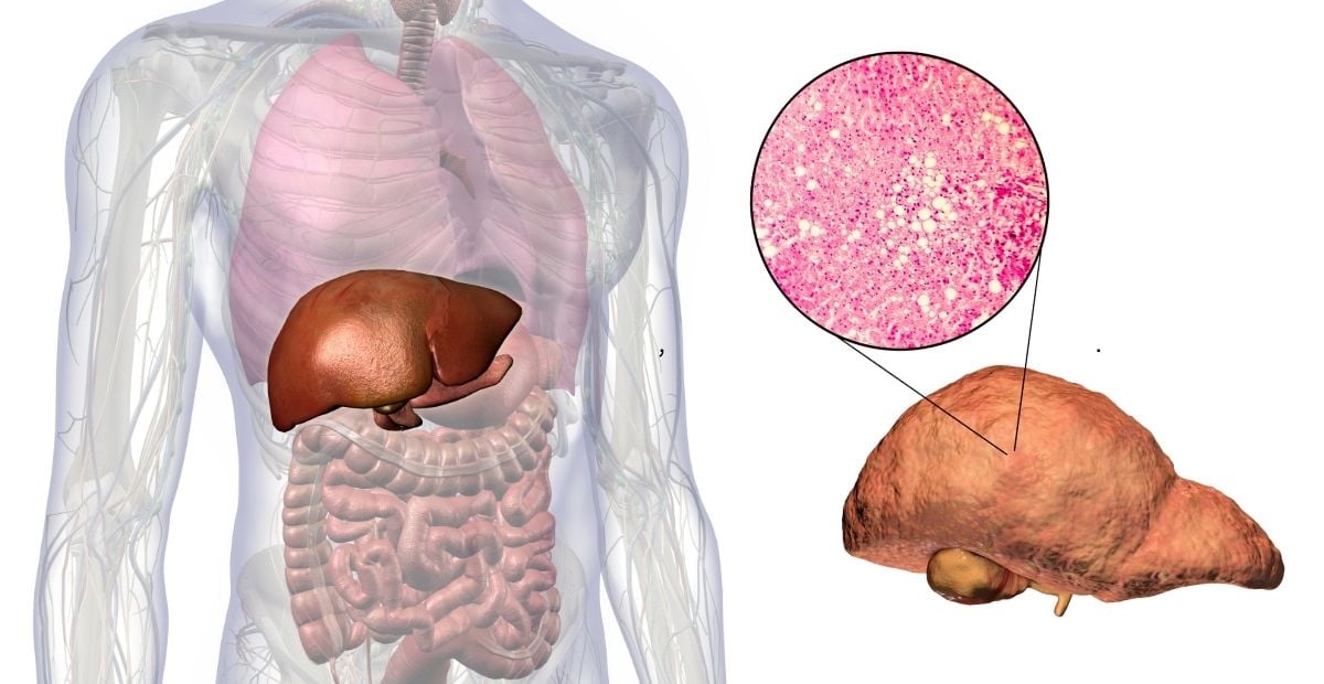 Image of a liver in the human body