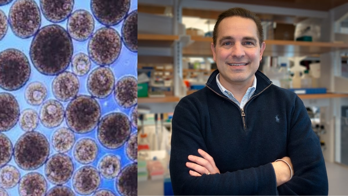 Headshot of Dr. Michael Brehm next to image of islet cells
