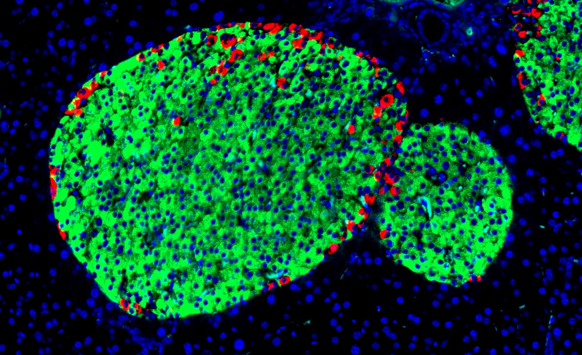 Beta Cells 