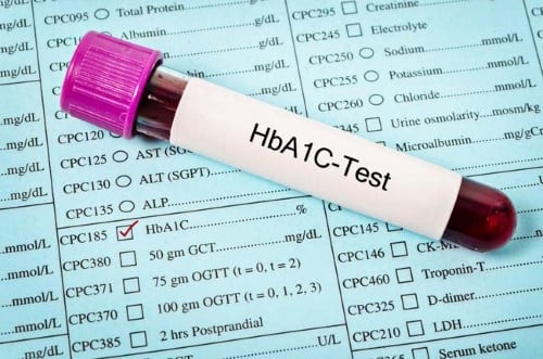 Diabetes A1c Test