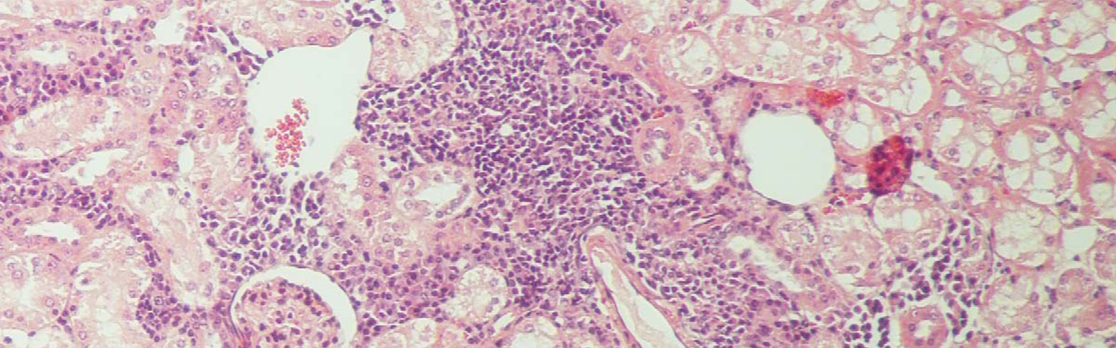 autoimmunity image