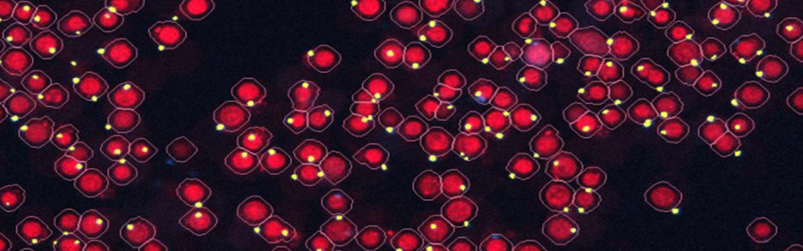 inflammasome
