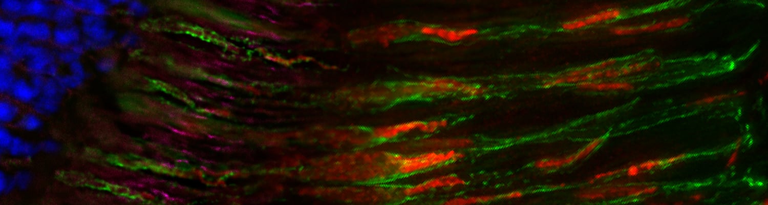 Dr. Hemant Khanna from the Khanna Lab (Horae Gene Therapy Center) is conducting research and developing therapeutic strategies for rare inherited diseases such as the Ciliopathies.