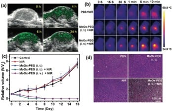 In vivo clearable inorganic nanophotonic materials: designs, materials and applications