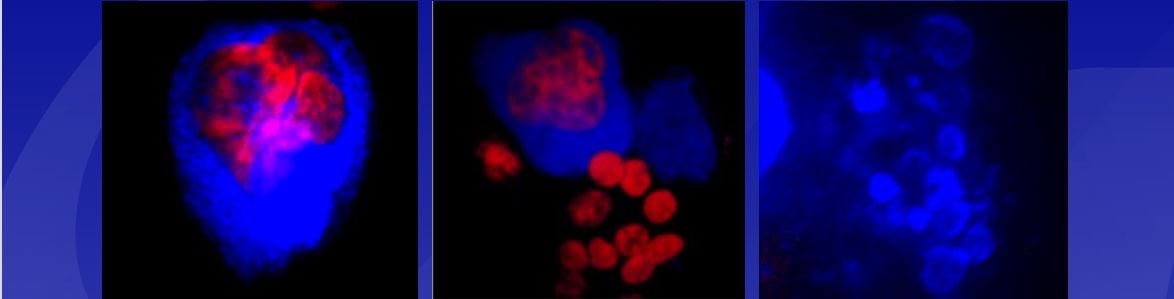 Platelets and MKs during infection