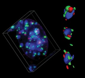 3D-image-composite BRCA