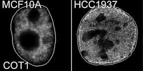 loss-peripheral-heterochromatin