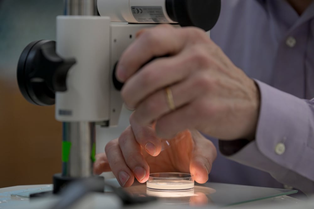 Close-up photo of Victor Ambros' hand holding an experimental gel under a microscope 