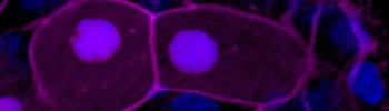  Cell life and death_tile.jpg