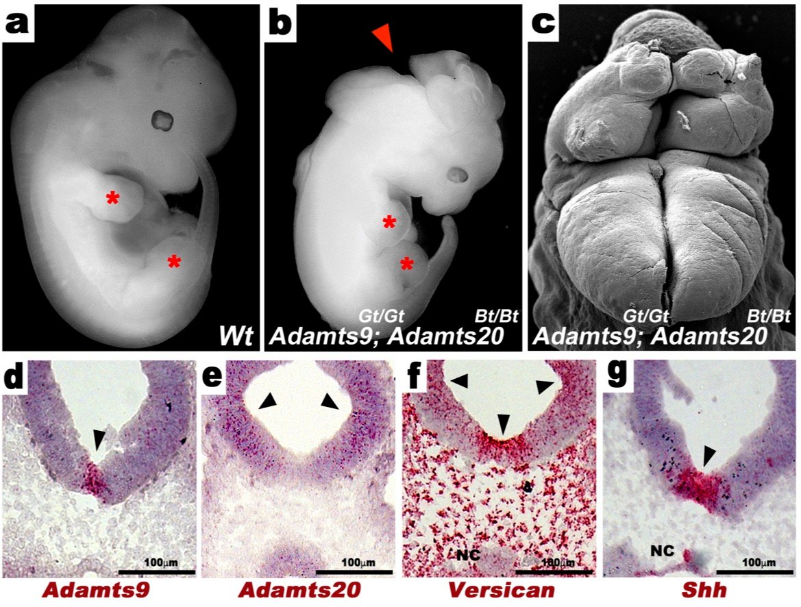 Neural Tube1