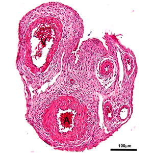  research-umbilical-cord.jpg