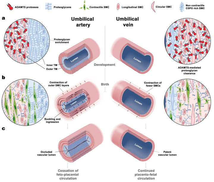 Umbilical3