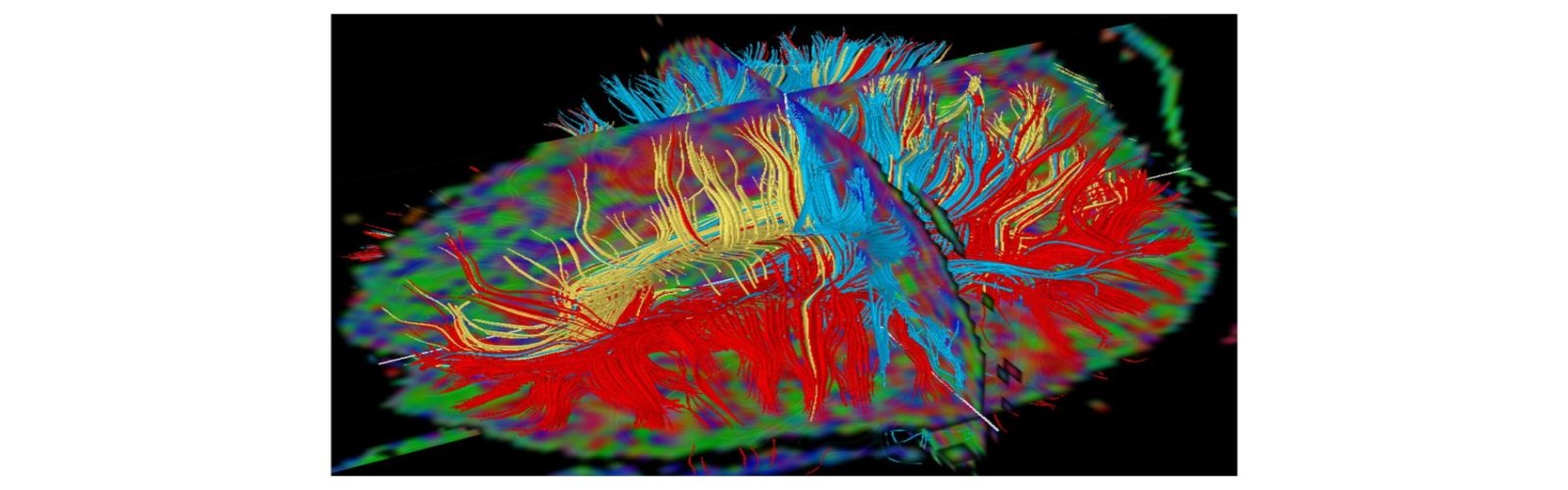 picture brain.jpg