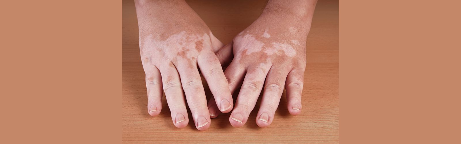 skin-core-hands-slide.png