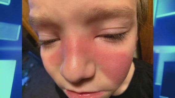 skinpicture.jpg