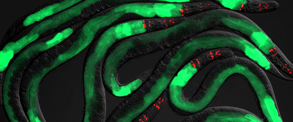 Innate immunity