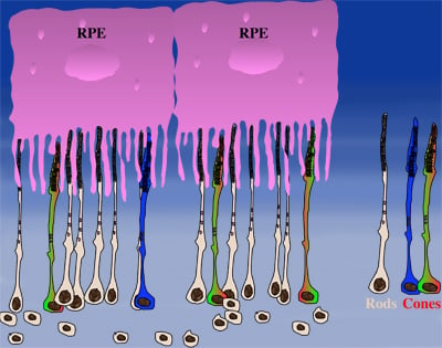 Onset of rod death