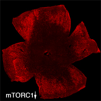 Loss of mTORC by 2 months of age