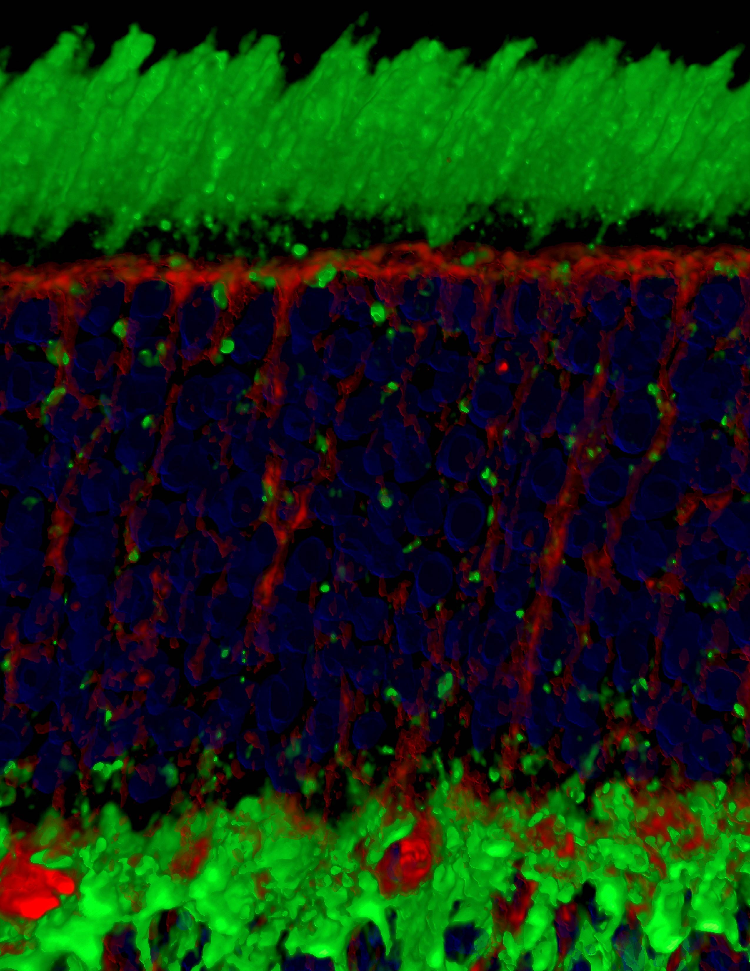 Aerobic glycolysis is essential for normal rod function and control secondary cone death in retinitis pigmentosa