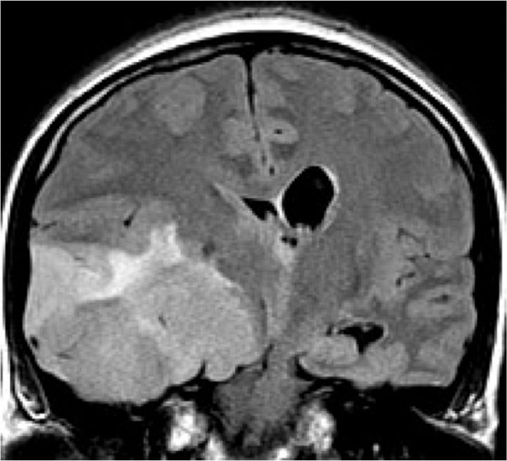 Neuroradiology