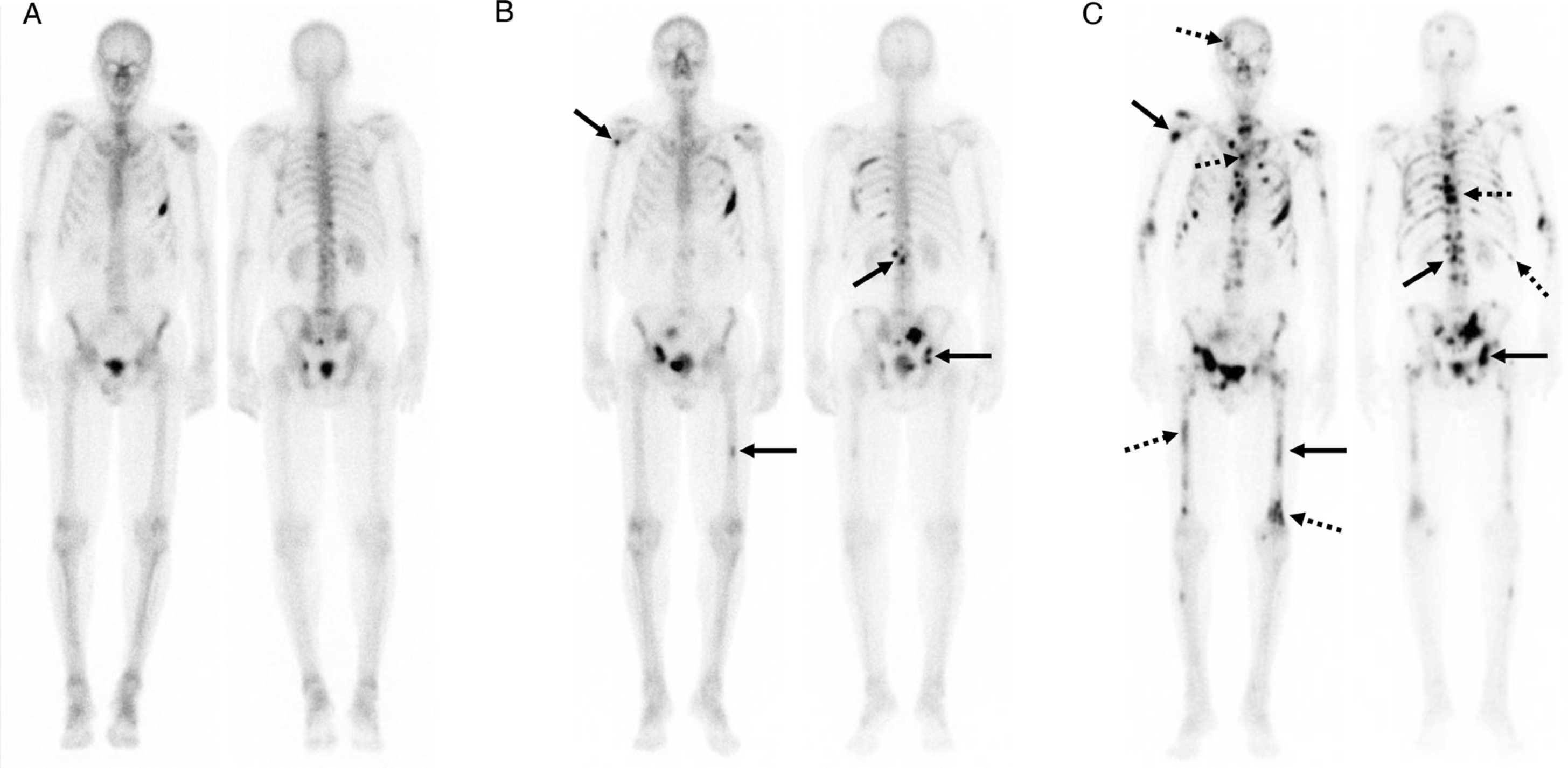 Imaging response assessment figure