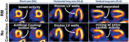 Clinical SPECT