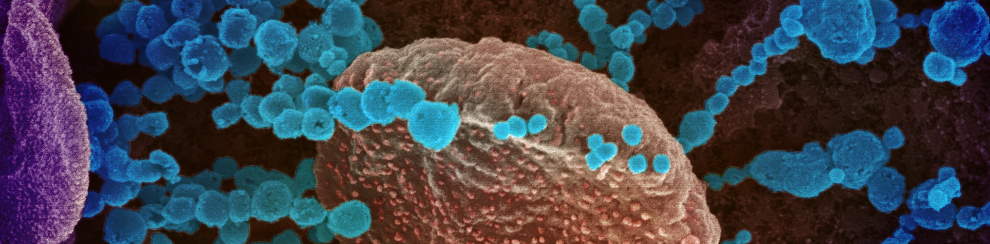 novel-coronavirus-sars-cov-2_49557550751_o.jpg