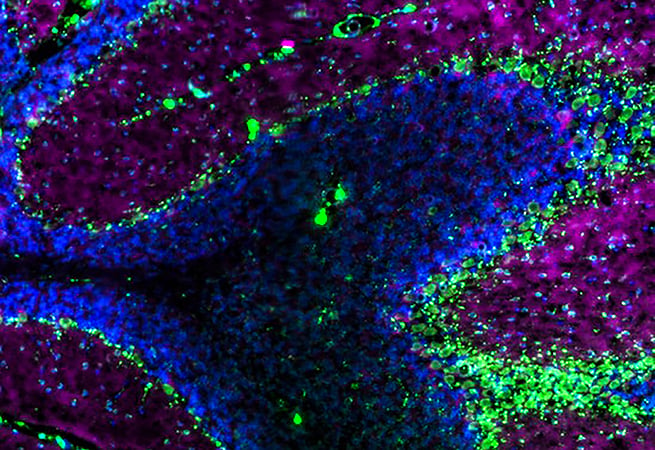 Mouse cerebellum