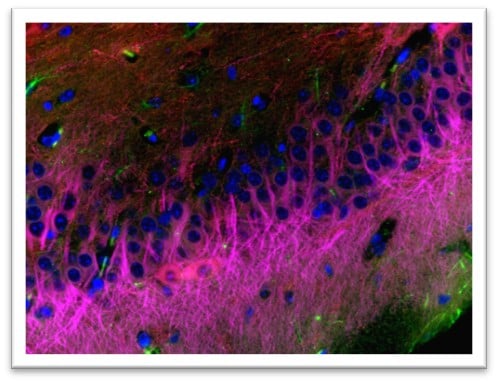 Stained Mouse Brain Tissue