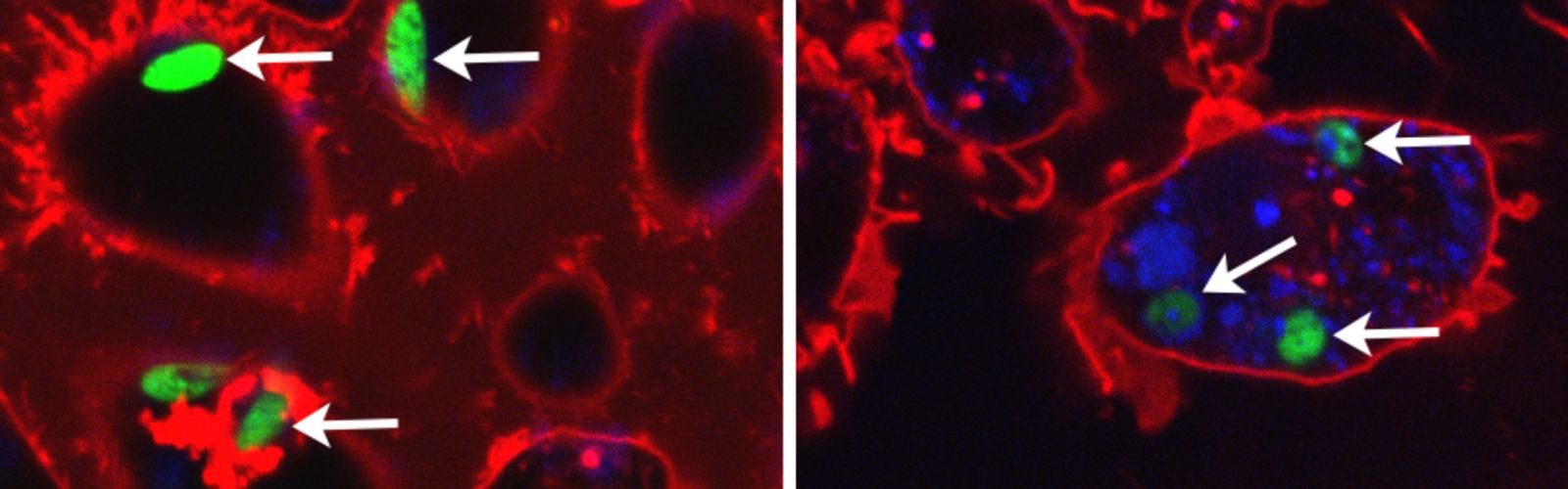 S2 confocal