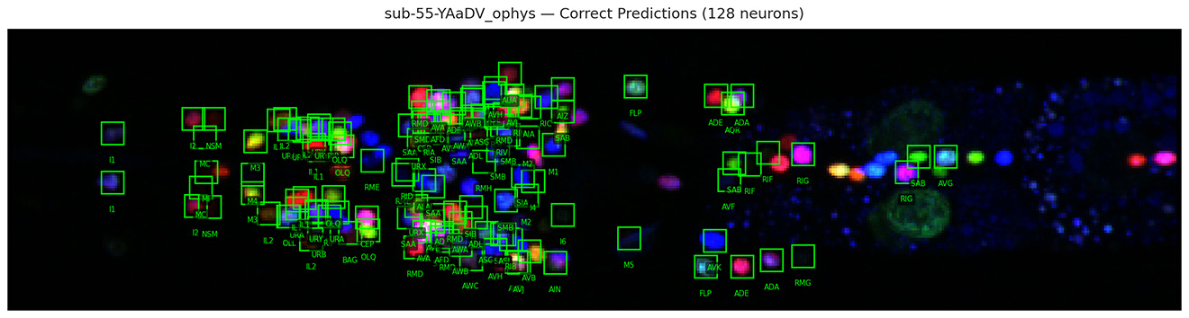 A protype of the AI algorithm identifies each C. elegans neuron in the image (green box) and labels it based on its position in the animal and neighboring cells.