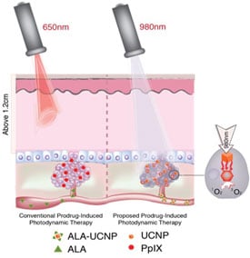 Research by Gang Han, PhD, shows that upconversion nanoparticles that can convert near-infrared light into red light can be used to extend photodynamic therapy for some cancers found in deeper tissues.