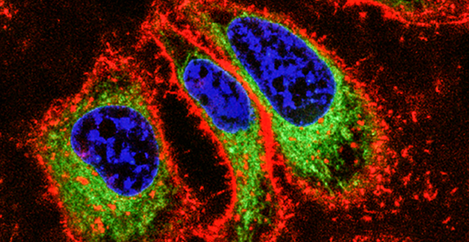 An image contributed by Marie-Cecile Didiot, PhD, postdoc in the lab of Anastasia Khvorova, PhD, professor of RNAi therapeutics, highlights delivery of a dose of an experimental therapeutic RNA for Huntington’s disease (shown in red) to a neuron.