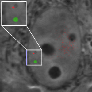 Dual-color CRISPR labeling of two DNA sequences on chromosome 9 in a live human cell.