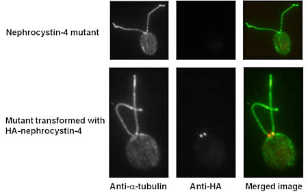 Nephrocystin-4